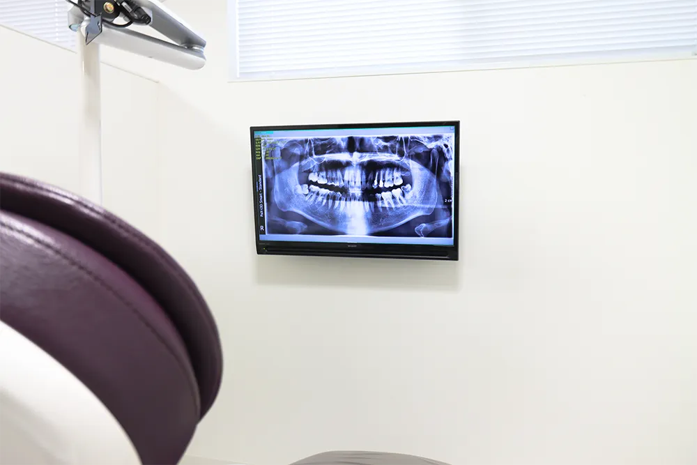 口腔レントゲンモニター